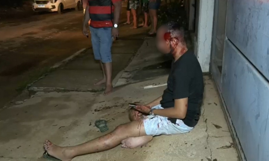 Vítima foi atingida com tiro de raspão. Foto: Araguaína Notícias