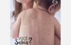 A SES-TO destaca que os casos registrados no Tocantins são o sexto e sétimo caso de sarampo no Brasil, em 2025, que já teve confirmações  no Distrito Federal (1), no Rio de Janeiro (2), em São Paulo (1) e no Rio Grande do Sul (1).