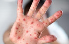  Campanhas de imunização seguem em todas as 323 salas de vacina do estado