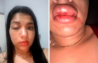 Mulher denunciou vereador por agressões em cidade do Tocantins