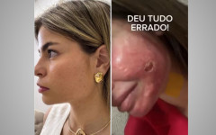 Arte mostra rosto de médica antes e depois de apresentar reações a procedimento