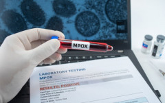 Os quadros leves a moderados predominam e não há óbitos. 