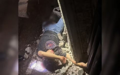 Adolescente fraturou as duas pernas após ser atropelado por viatura da PM, em Alvorada (TO) 