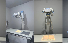 Aparelho de raio-X do Hospital Municipal de Ananás amplia o acesso da população a exames de diagnóstico