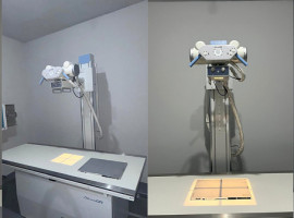 Aparelho de raio-X do Hospital Municipal de Ananás amplia o acesso da população a exames de diagnóstico