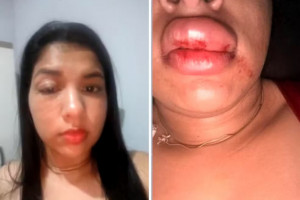 Mulher denunciou vereador por agressões em cidade do Tocantins