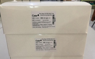 Foram compradas 1.000 unidades pela Prefeitura, que já serão usadas em dez casos suspeitos