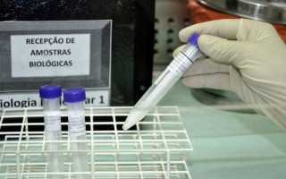 Antes a capacidade de testagem era de 140 por dia e hoje ampliou para 300 por dia.