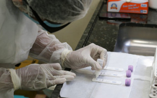 Aquisição de testes rápidos ainda no início da pandemia