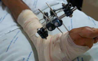 A maioria dos pacientes internados são vítimas de acidentes de trânsito