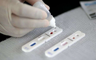 Nove laboratórios, um hospital e duas farmácias foram notificados pelo Procon por supostos preços elevados de testes de Covid 