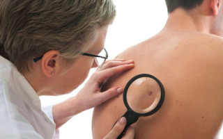 O câncer de pele é o mais frequente no Brasil.