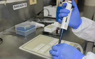 O LACEN-TO continua com as ações de Vigilância Laboratorial e seleção das amostras positivas para SARS-CoV-2.