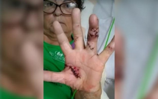 Dona Santa Godoi foi esfaqueada em janeiro deste ano por um vizinho em Palmas.