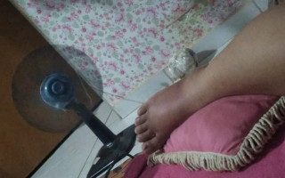 Professora descobre picada de aranha após ficar com o pé bastante inchado, em Araguaína 