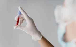 Os exames hormonais são procedimentos de rotina feitos a partir de uma amostra de sangue do paciente.