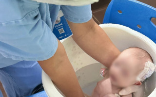 Paciente Júlia Carneiro durante ofuroterapia. 