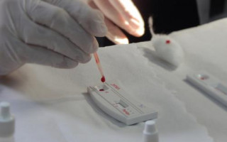 Testes rápidos de HIV e sífilis serão ofertados no Câmpus da UFT de Araguaína