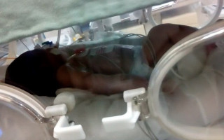 No ano passado, 19 bebês morreram à espera de cirurgia ou porque não resistiram ao procedimento