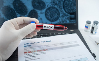 Os quadros leves a moderados predominam e não há óbitos. 