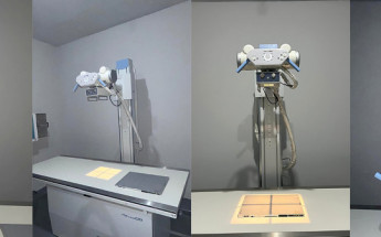 Aparelho de raio-X do Hospital Municipal de Ananás amplia o acesso da população a exames de diagnóstico