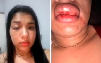 Mulher denunciou vereador por agressões em cidade do Tocantins