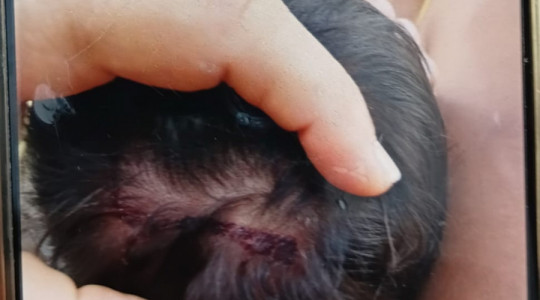 O caso foi registrado na tarde desta quarta-feira (11), no setor Maracanã. 