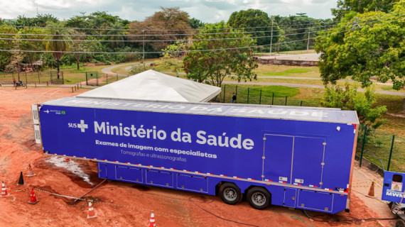 Unidade móvel fará até 60 exames por dia em Araguaína.