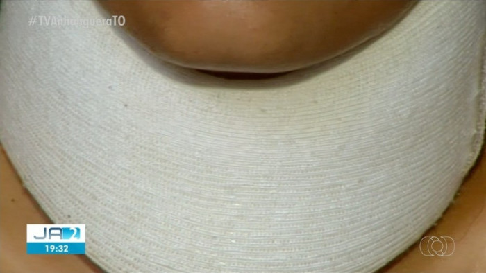 Adolescente precisou imobilizar o pescoço após se machucar no desafio da rasteira. Foto: Reprodução/TV Anhanguera